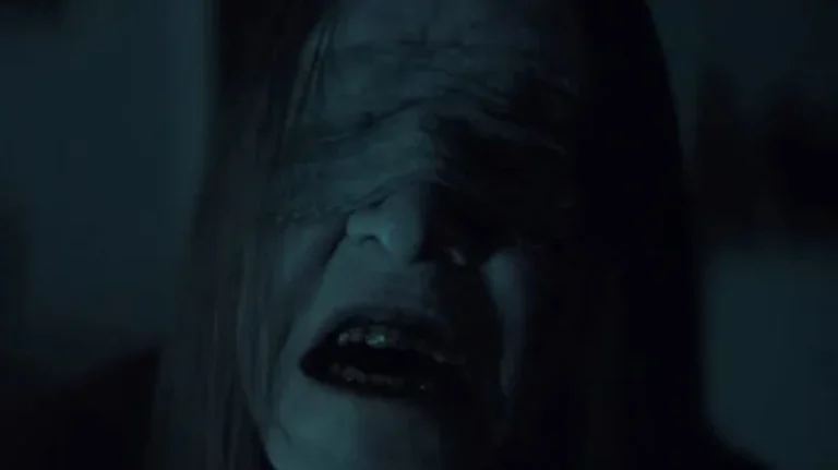 In the Out of the Further mid-credits scene, Cyrus goes to the dentist